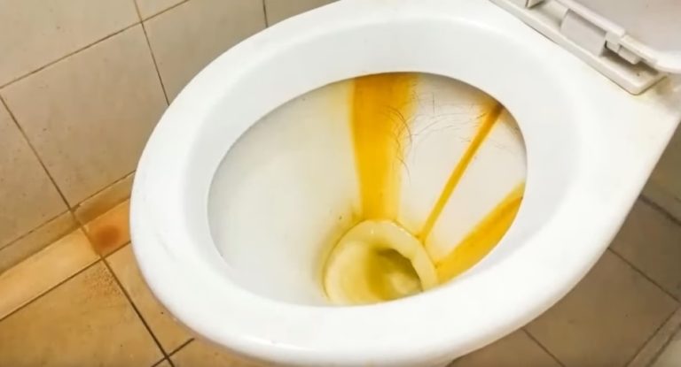 How to Remove Yellow Stain In Toilet Bowl? Explained