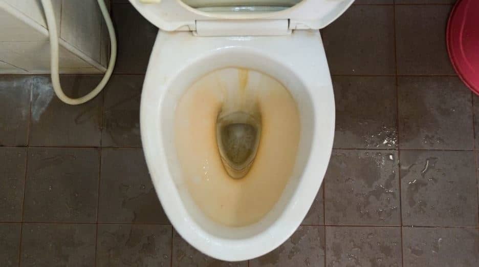 How to Remove Yellow Stain In Toilet Bowl? Explained